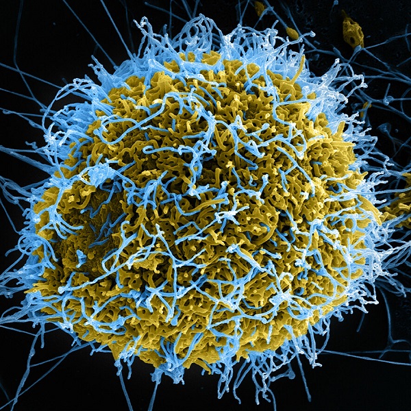 伊波拉病毒 - 嚴峻時期 - 中英物語 ChToEn